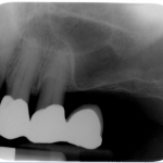 Screen-Shot-2016-01-12-at-6.42.42-PM