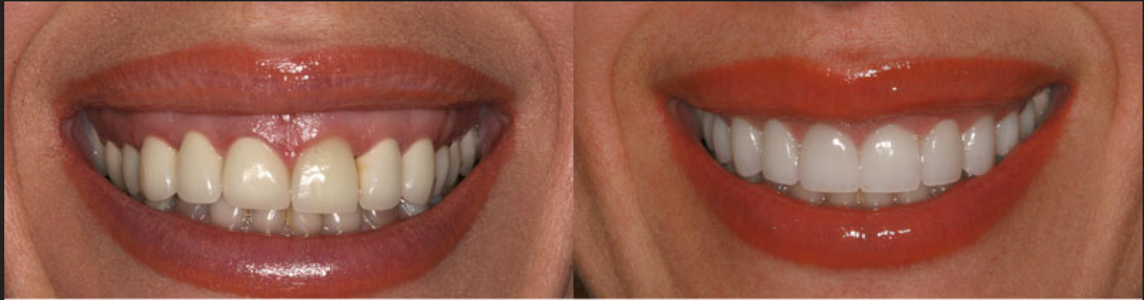 Screen Shot 2016-01-26 at 9.31.42 PM