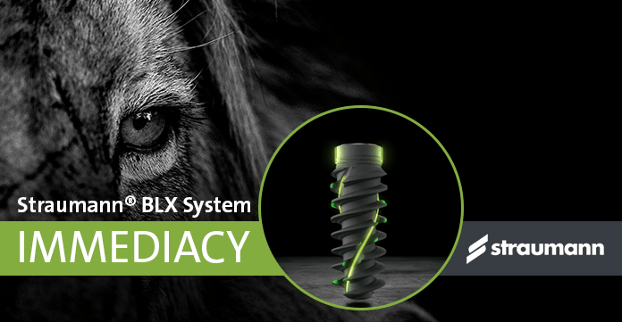 Straumann implants in Vancouver BC Burnaby BC